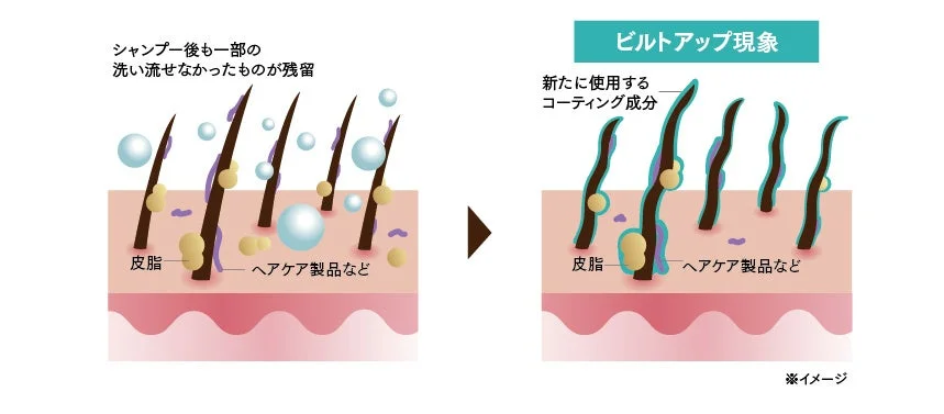 ビルドアップ現象