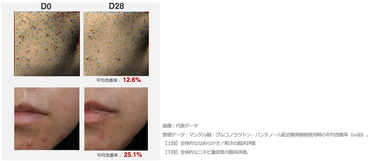 なめらかさ、ニキビ軽減の改善例